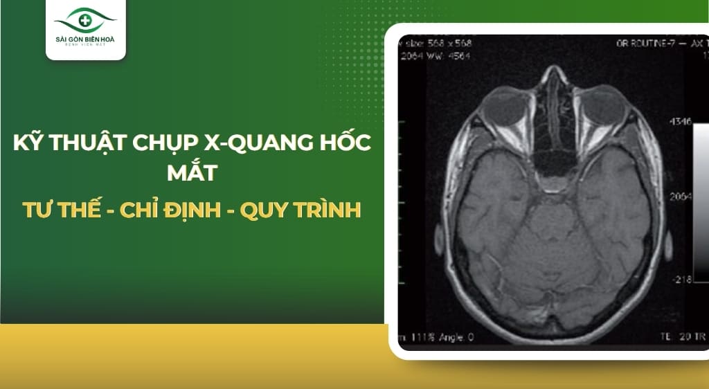 Kỹ thuật chụp X-quang hốc mắt
