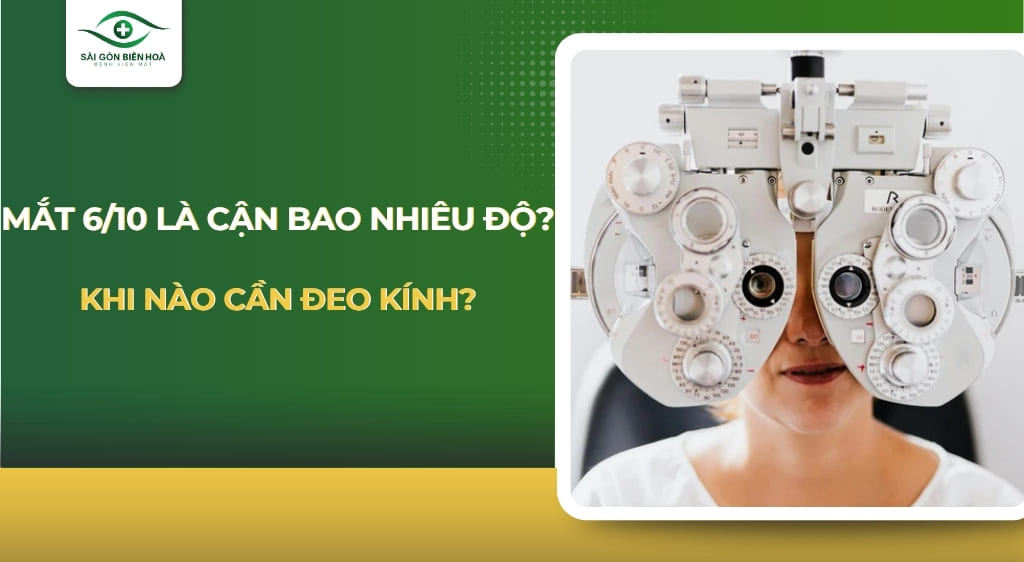 Mắt 6/10 là cận bao nhiêu độ