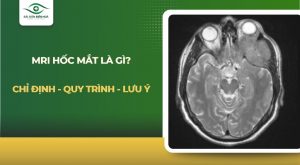 MRI hốc mắt