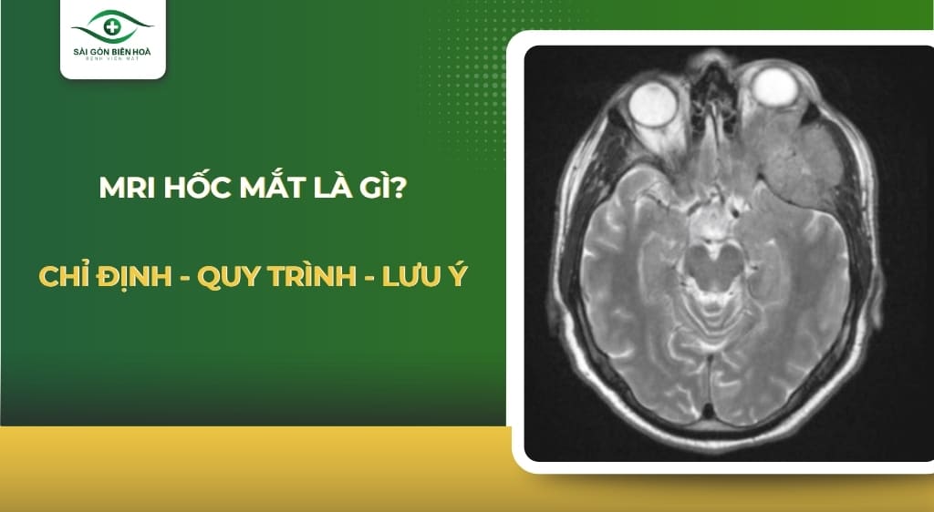 MRI hốc mắt