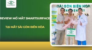 Review mổ mắt SmartSurfACE