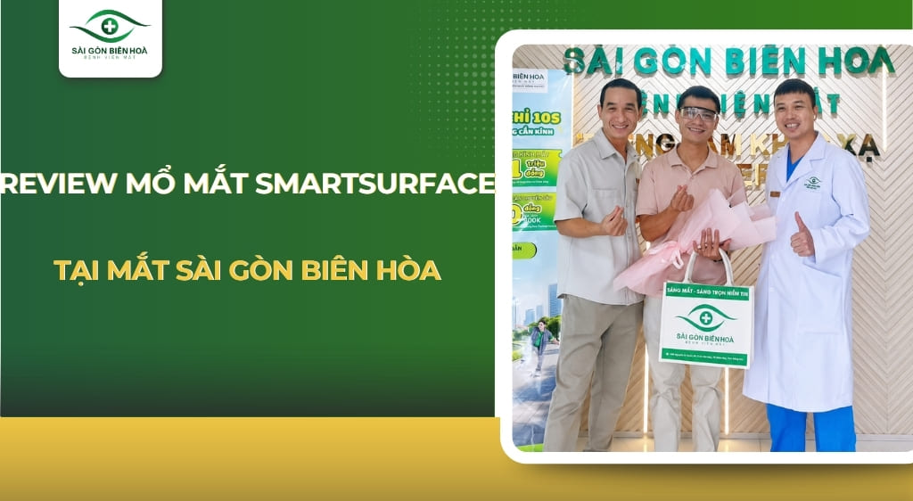 Review mổ mắt SmartSurfACE