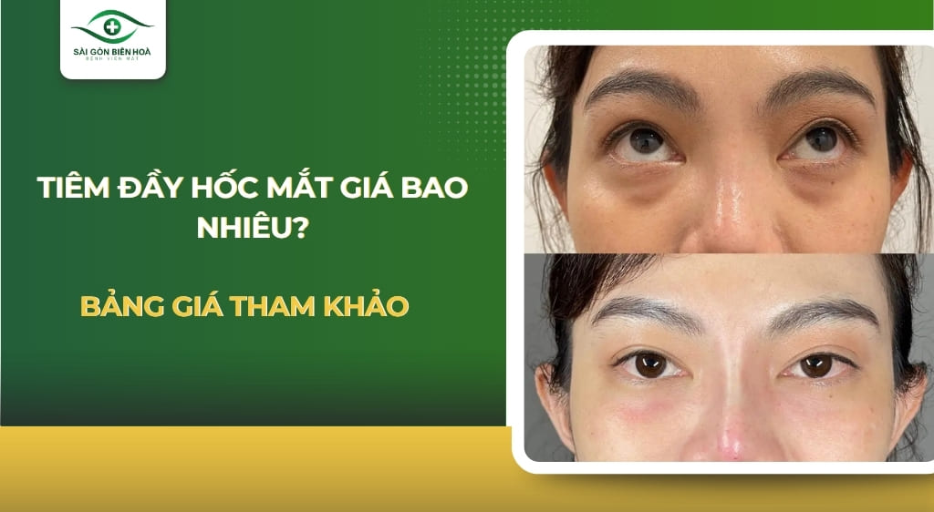 tiêm đầy hốc mắt giá bao nhiêu