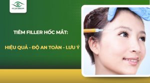 Tiêm filler hốc mắt