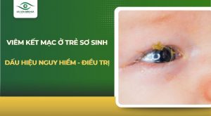 Viêm kết mạc ở trẻ sơ sinh