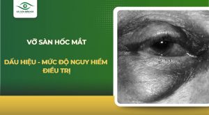 Vỡ sàn hốc mắt